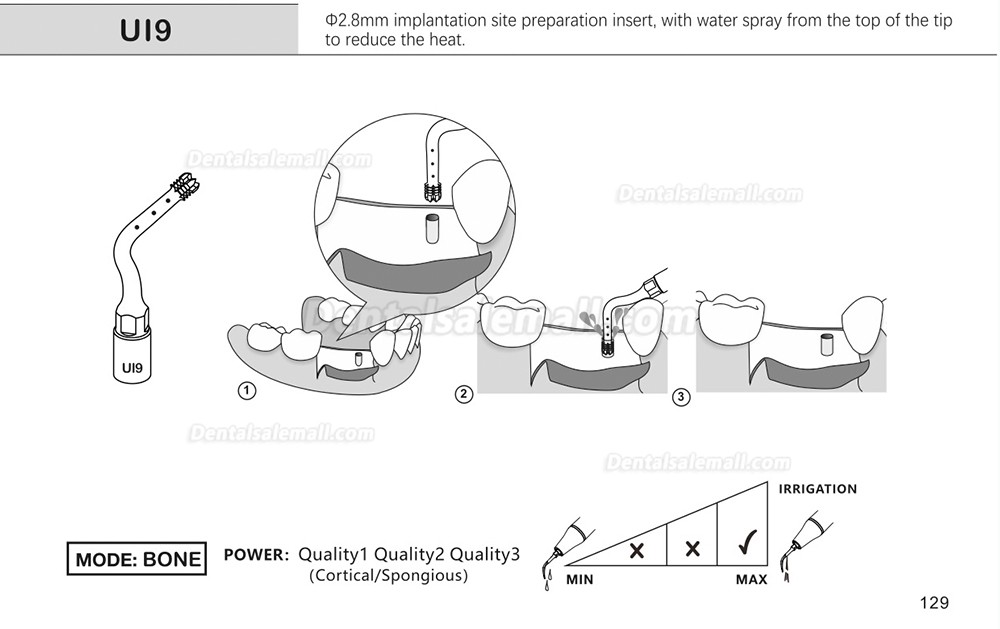 1Pcs Dental Piezosurgery Tips For Bone Cutting Sinus lifting Implant Ul1 UI2 UI3 UI4 UI5 Dental Surgery Tip Fit Mectron Woodpecker