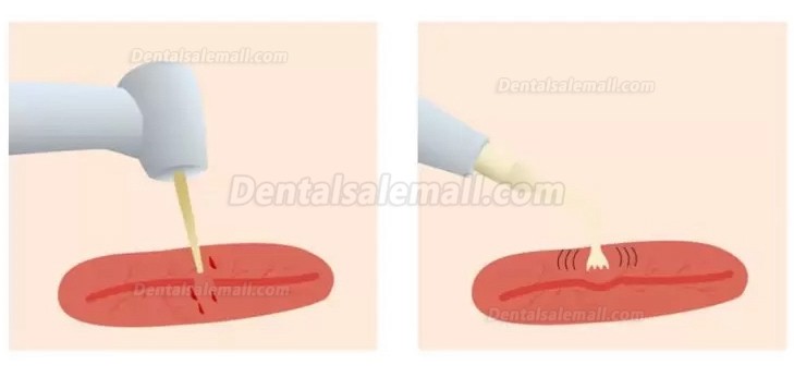 Refine MaxSurgery Dental Piezosurgery Unit Ultrasonic Piezo Bone Surgery System Piezo Surgery Machine