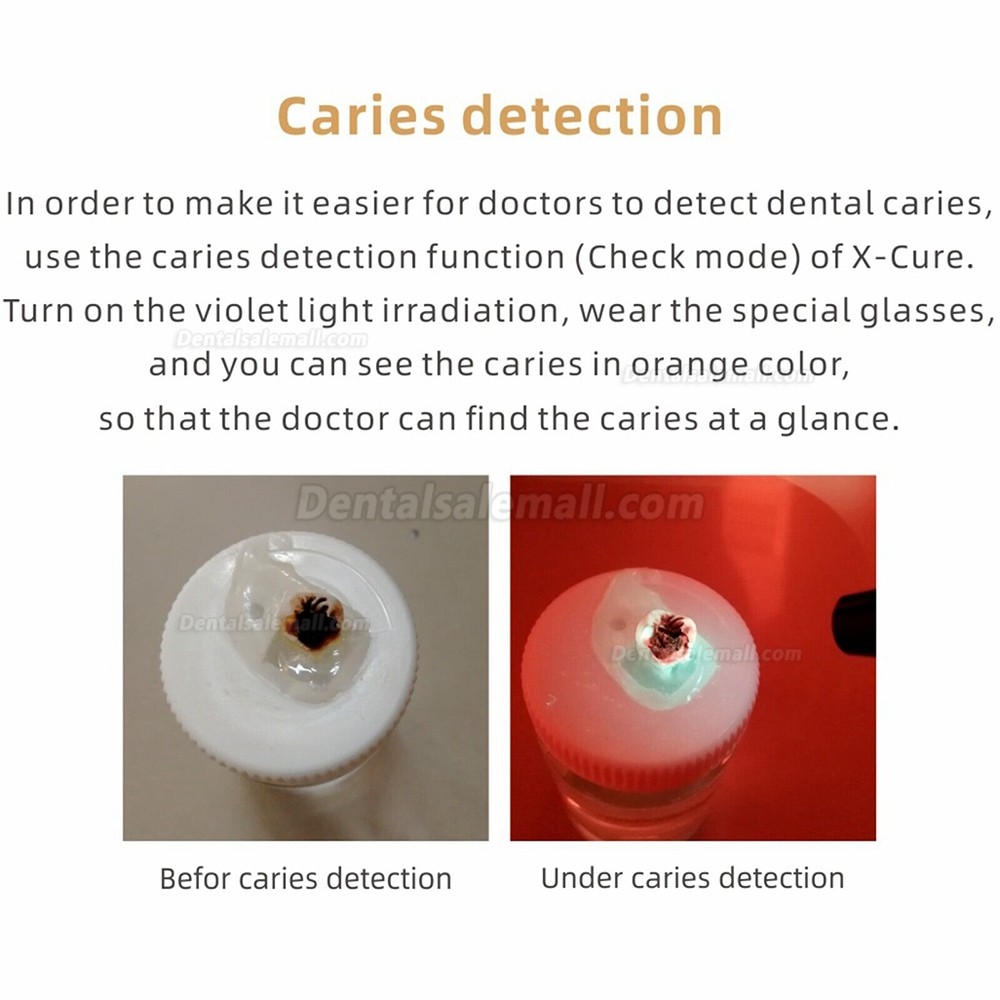 Woodpecker X-Cure Dental Wireless LED Curing Light with Caries Detection 3000mw/cm