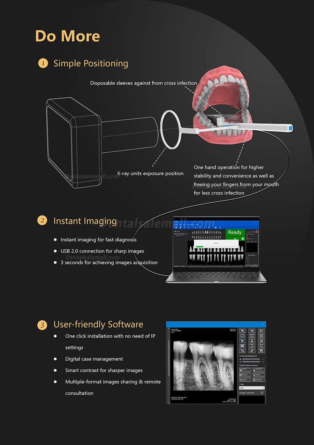 Dental Digital Image RVG X-Ray Sensor Dental Intraoral Imaging System