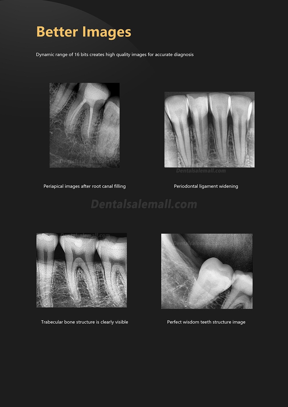 Dental Digital Image RVG X-Ray Sensor Dental Intraoral Imaging System