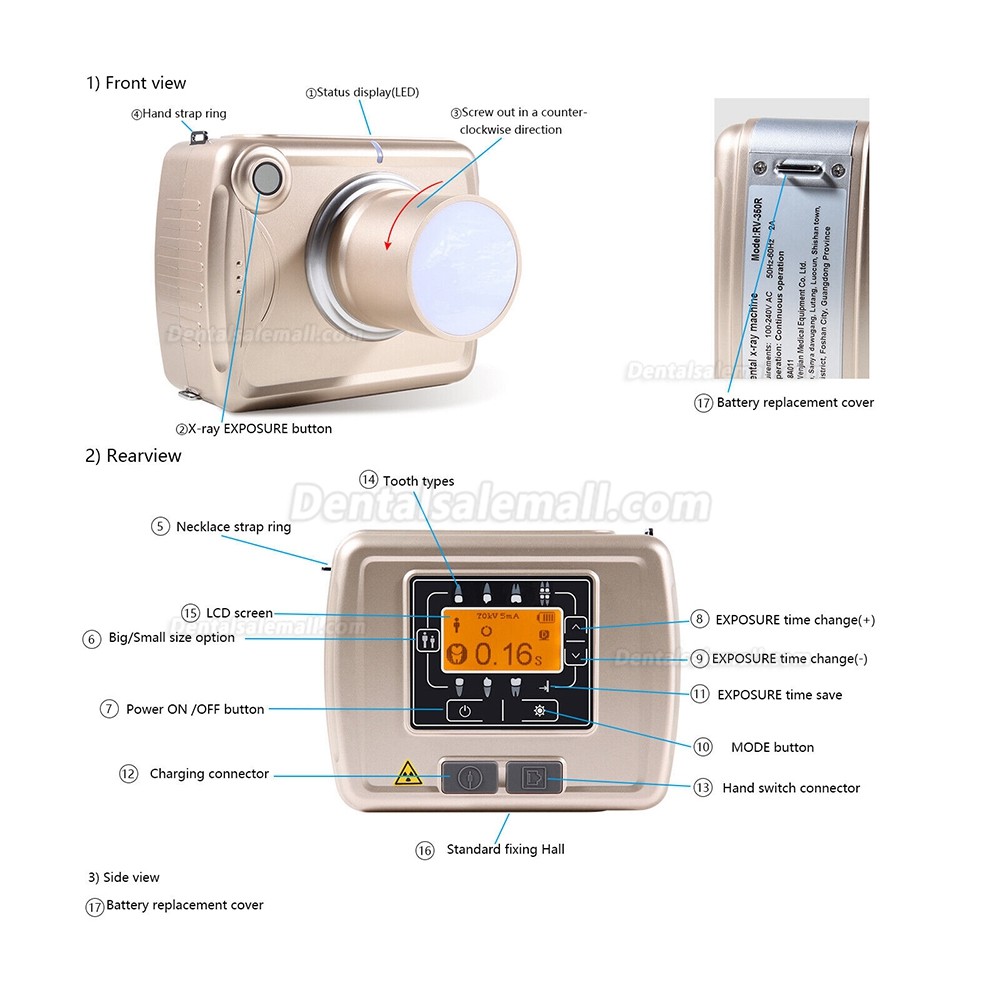 MobileRay-500 Portable Dental X-Ray Machine – High Frequency Digital Image System, 60KV, 2mA