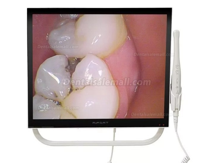 Magenta YFHD-D Dental Intraoral Camera 1/4 sony CCD 17 Inch Monitor & Support Arm Bracket