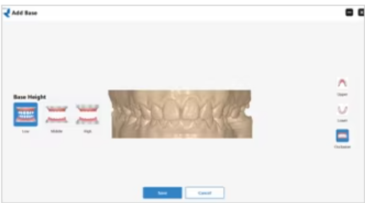 YP-11 Dental 3D Intraoral Scanner with Color Scanning for Restorative, Implant and Orthodontic