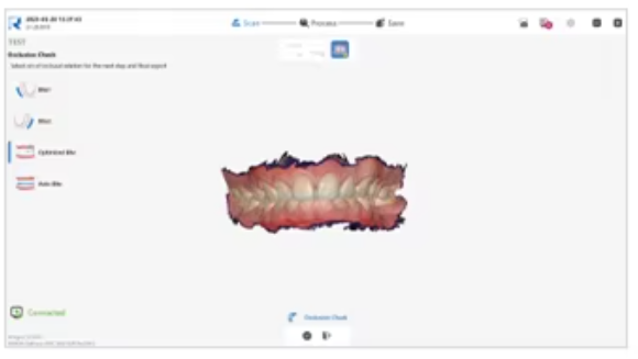YP-11 Dental 3D Intraoral Scanner with Color Scanning for Restorative, Implant and Orthodontic