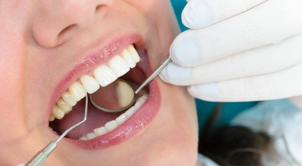 check-cracked-tooth-with-intraoral-camera
