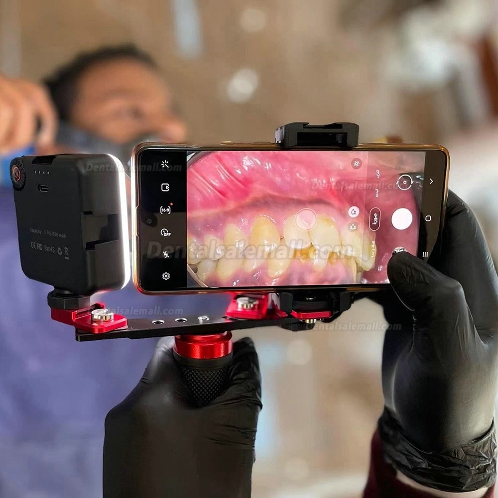 Dental Adjustment Oral Photography Flash Light Mobile Phone Dental ...