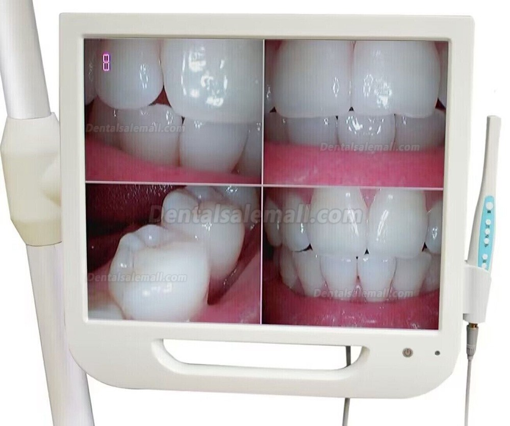 17 Inch High-Definition Digital LCD AIO Monitor Dental Intra oral Camera