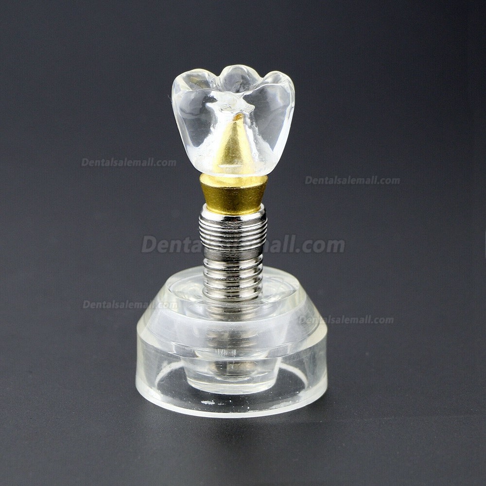 Dental Implant Demonstration Model 2.5x Size Detachable Transparent 2020