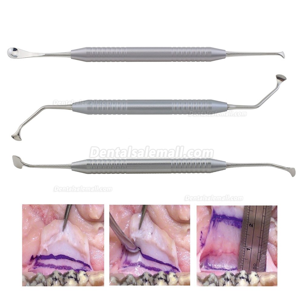 Dental WEN Tension Release Comb Set Periosteal Serrated GBR Primary Closure