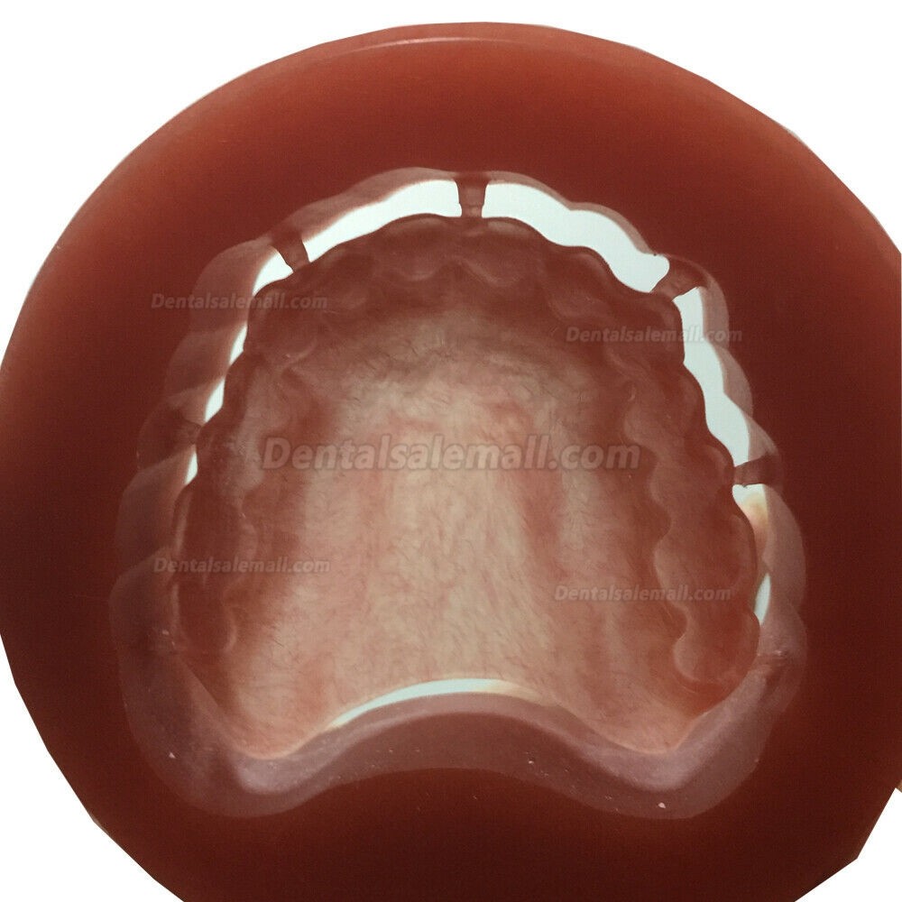 5 Pcs Dental Lab Material Wieland System Pink PMMA Blocks Disk with Bloodshot