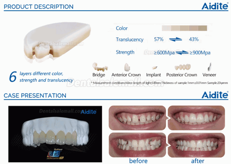 1PCS Aesthetic Restoration Zirconia Multilayer Dental Zircon Blocks Denture Material