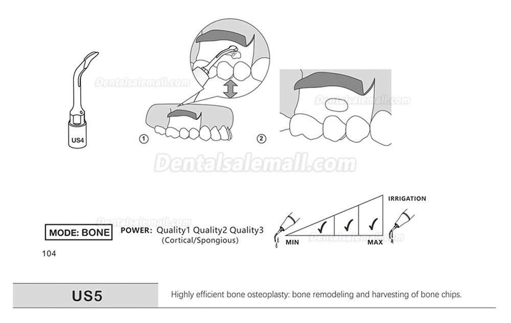 1Pcs Piezosurgery Osteotomy Bone Cutting Dental Surgery Tips US1 US1L US1R US2 US3 US4 US5 US6 US7 US11 US12 Fit Mectron Woodpecker