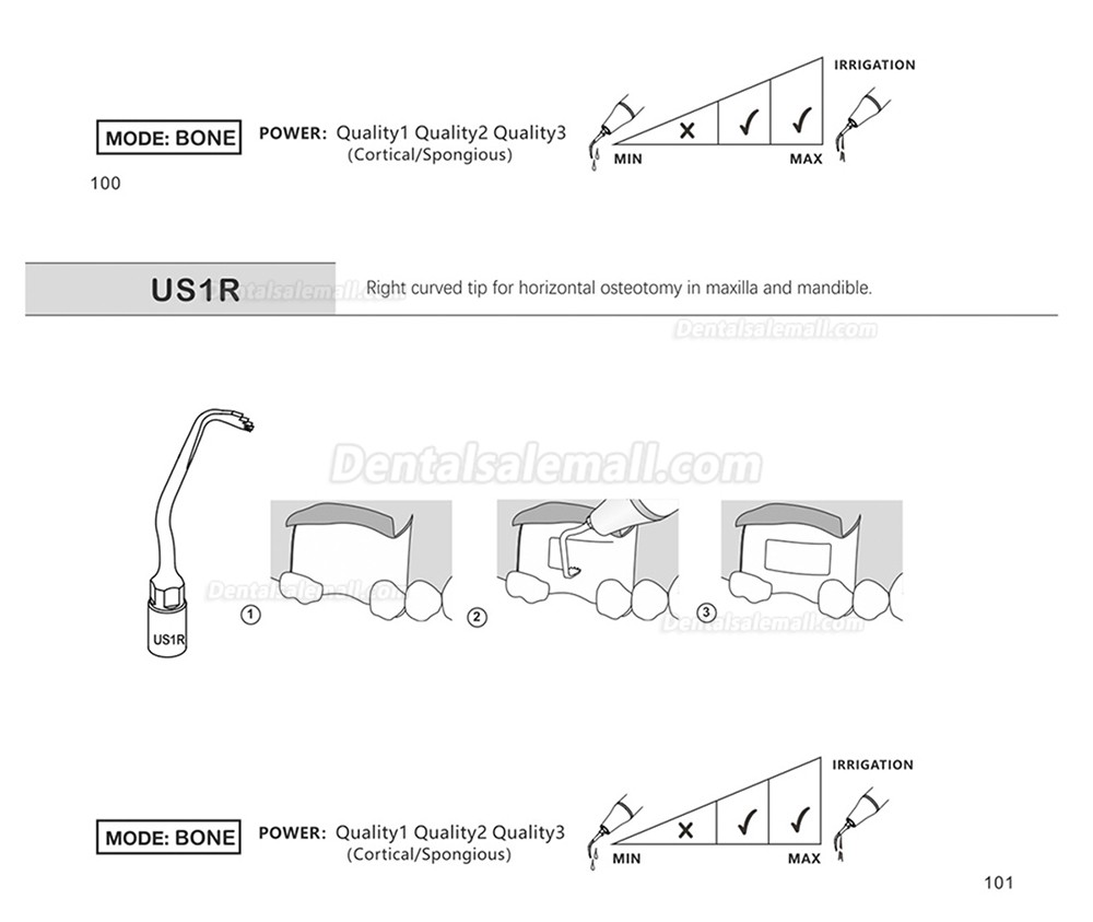 1Pcs Piezosurgery Osteotomy Bone Cutting Dental Surgery Tips US1 US1L US1R US2 US3 US4 US5 US6 US7 US11 US12 Fit Mectron Woodpecker