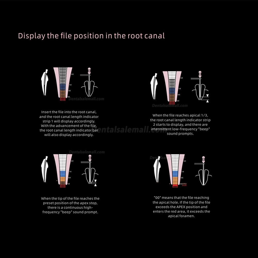 Woodpecker Woodpex V Endodontic Apex Locator Dental Root Canal Finder