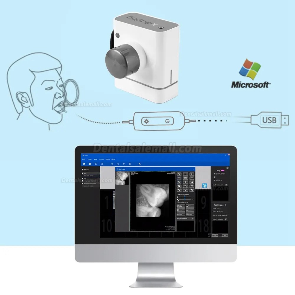 Dental Digital Image RVG X-Ray Sensor Dental Intraoral Imaging System ...