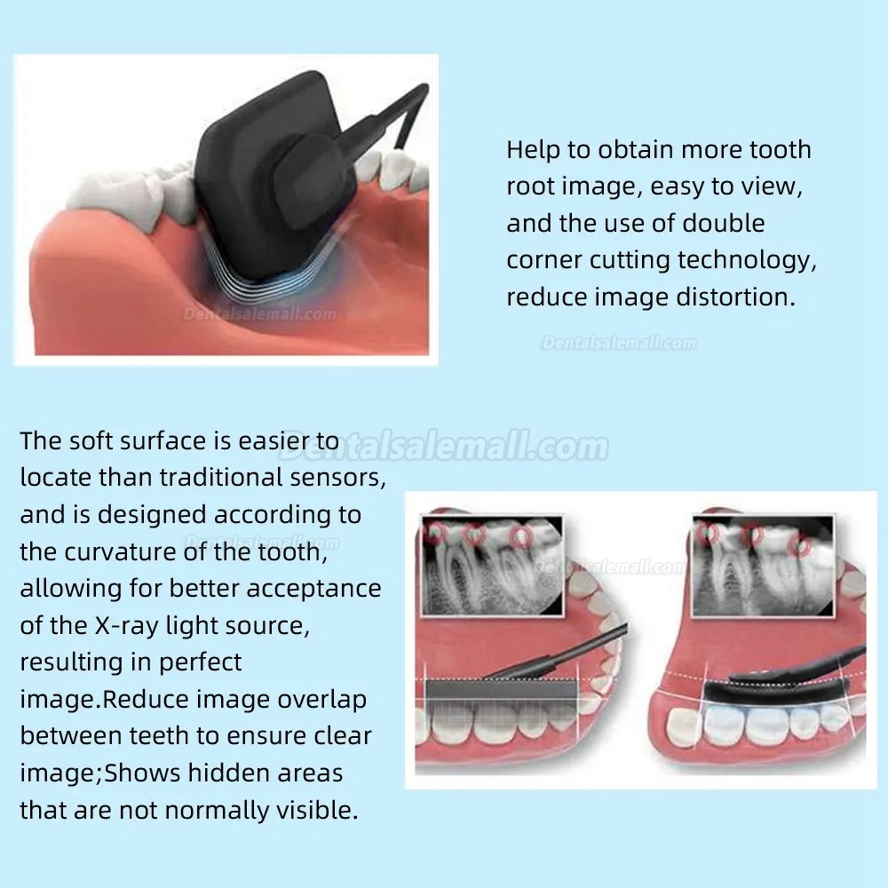 Dental Digital Image RVG X-Ray Sensor Dental Intraoral Imaging System ...